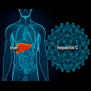 Cara Mengobati Hepatitis