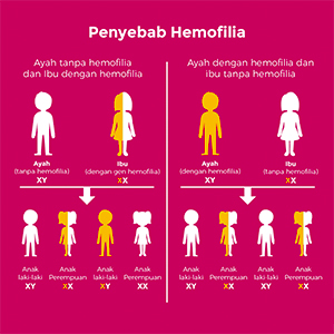 Obat Hemofilia Tradisional